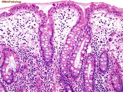 webpathology|Pathology examination questions for medical .